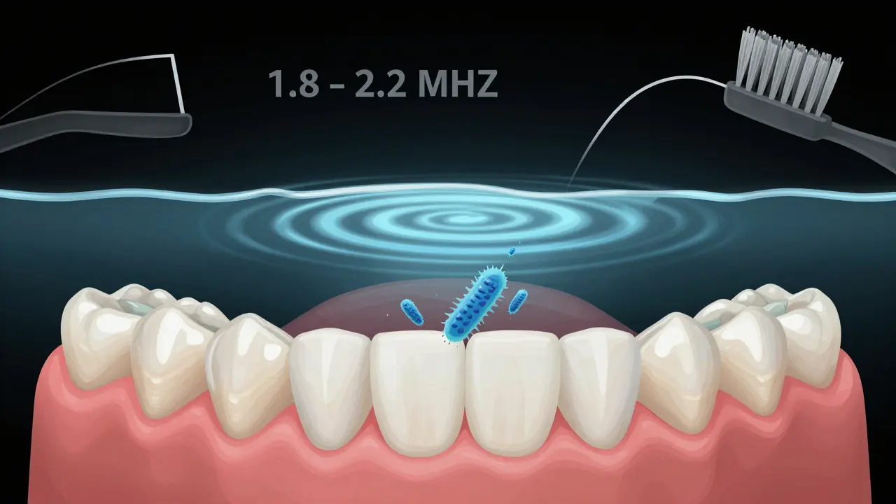 Konceptuální zobrazení ústní dutiny s ultrazvukovými vlnami odstraňujícími plak pod dásněmi.