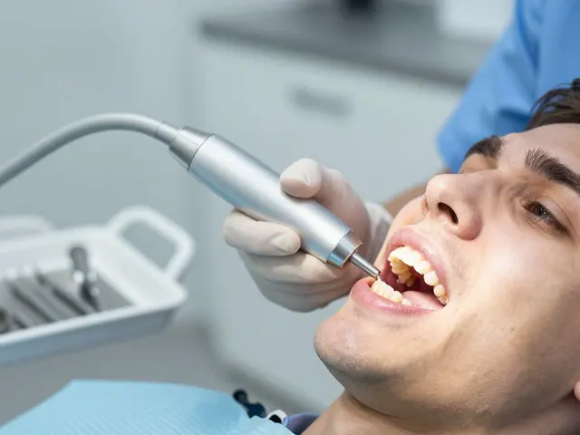 Odstranění zubního kamene: Proč to nemůžete ignorovat