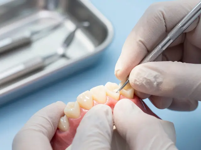 Zubní fazety: Jaké jsou možnosti pro zubní problémy?