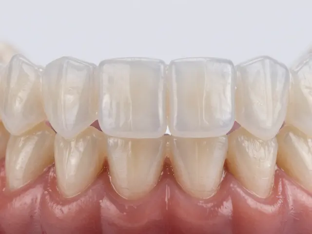 5 častých otázek o snímacích rovnátkách: komplexní průvodce ceny i účinnosti