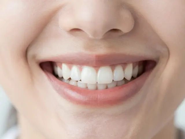 Estetické fazety: Jak získat dokonalý úsměv a na co si dát pozor