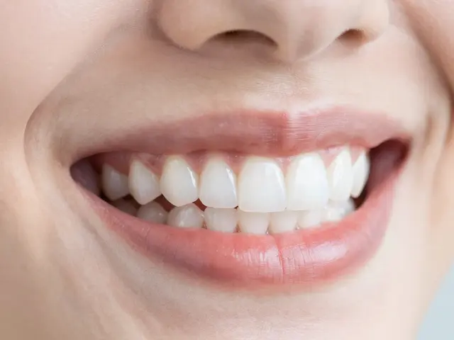 Jak se o estetické fazety správně starat: Průvodce pro dlouhotrvající úsměv