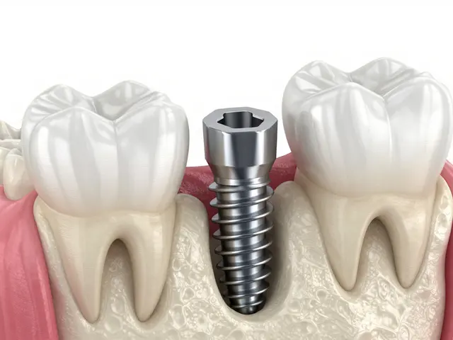 Zubní implantáty: Kompletní průvodce pro pacienty