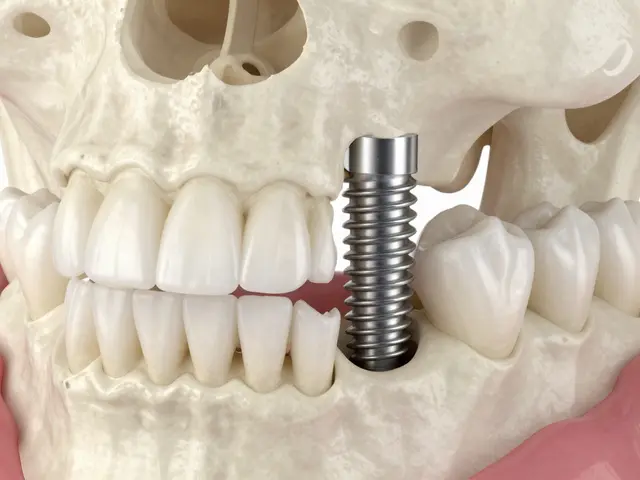 Jak dlouho vydrží zubní implantát? Průměrná životnost, rizika a tipy pro péči