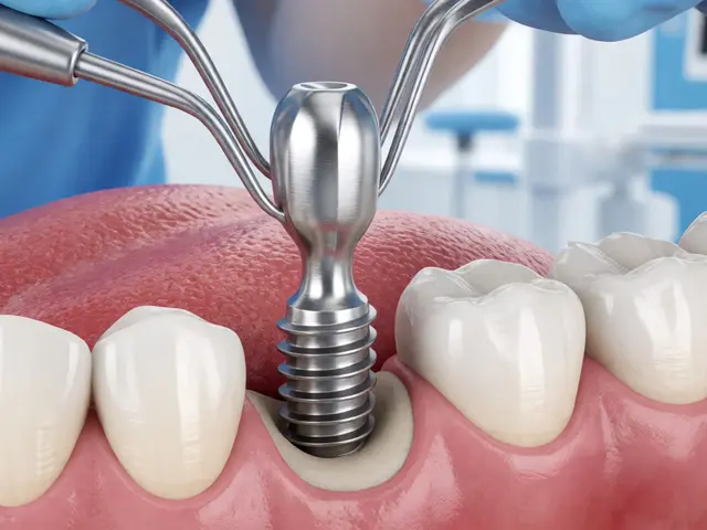 Jak dlouho trvá nasazení korunky na implantát? Časový harmonogram a proces
